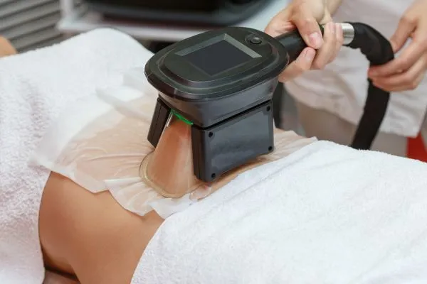 Image of person having fat freezing treatment to help weight gain Craigmillar