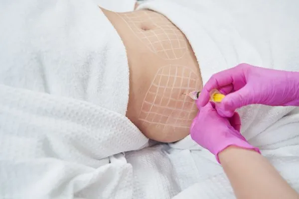 image of fat dissolving injections on love handles to help combat weight gain Craigmillar