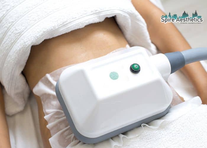 Shift Those Extra Pounds: How Fat Freezing Can Help You Slim Down Craigmillar