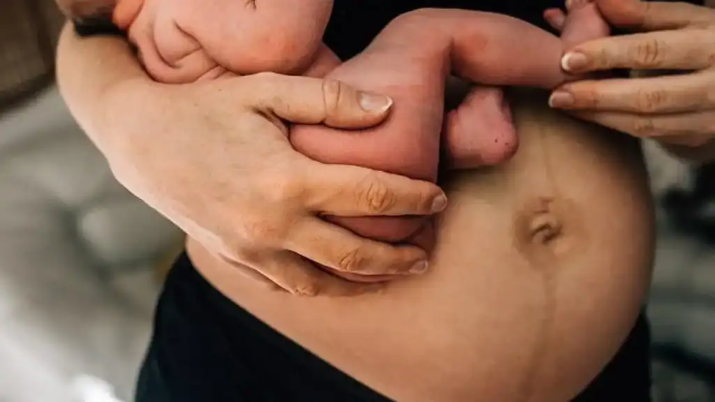 Why Is My Stomach Still Big After Pregnancy Craigmillar?